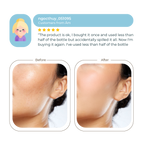 Abera Melasma Serum Treatment 30ml