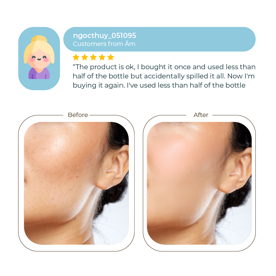 Abera Melasma Serum Treatment 30ml