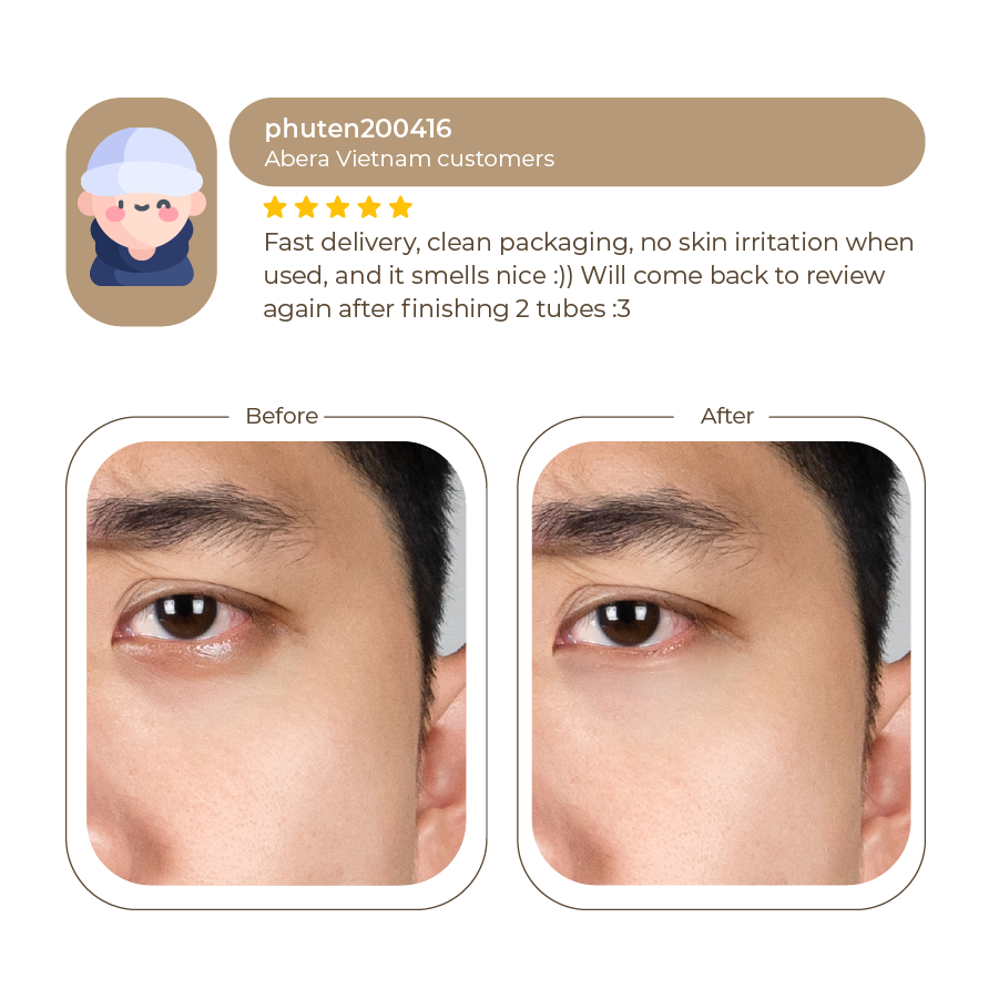 Abera Eye Cream 15ml