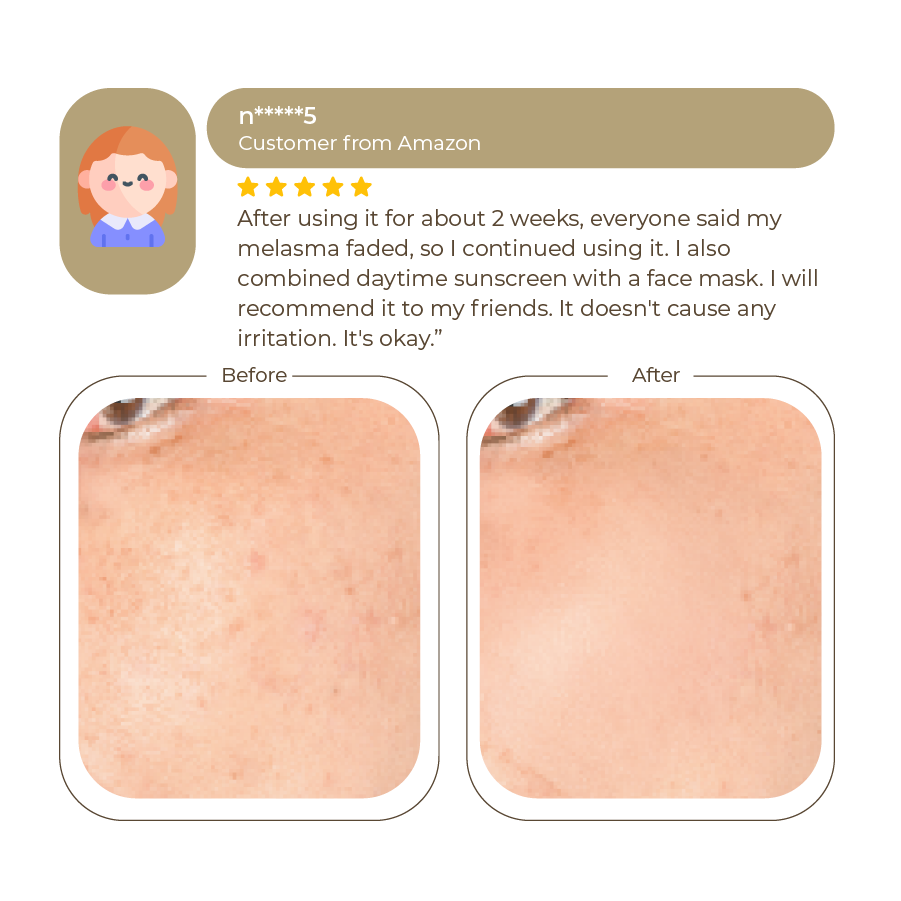 Abera Melasma Treatment Cream 30ml