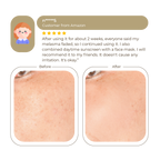 Abera Melasma Treatment Cream 30ml