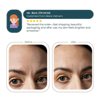 Abera Anti-Wrinkle Cream 30ml