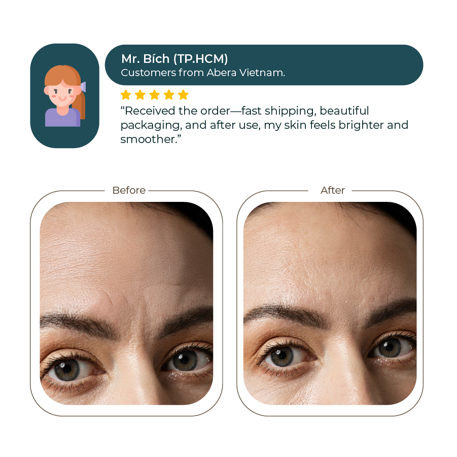 Abera Anti-Wrinkle Cream 30ml