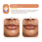 Abera Dark Lip Correcting Cream 10ml