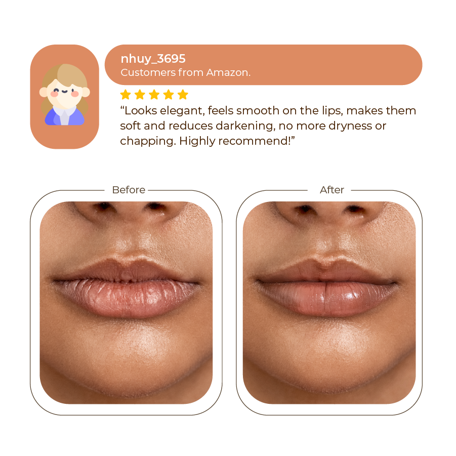 Abera Dark Lip Correcting Cream 10ml