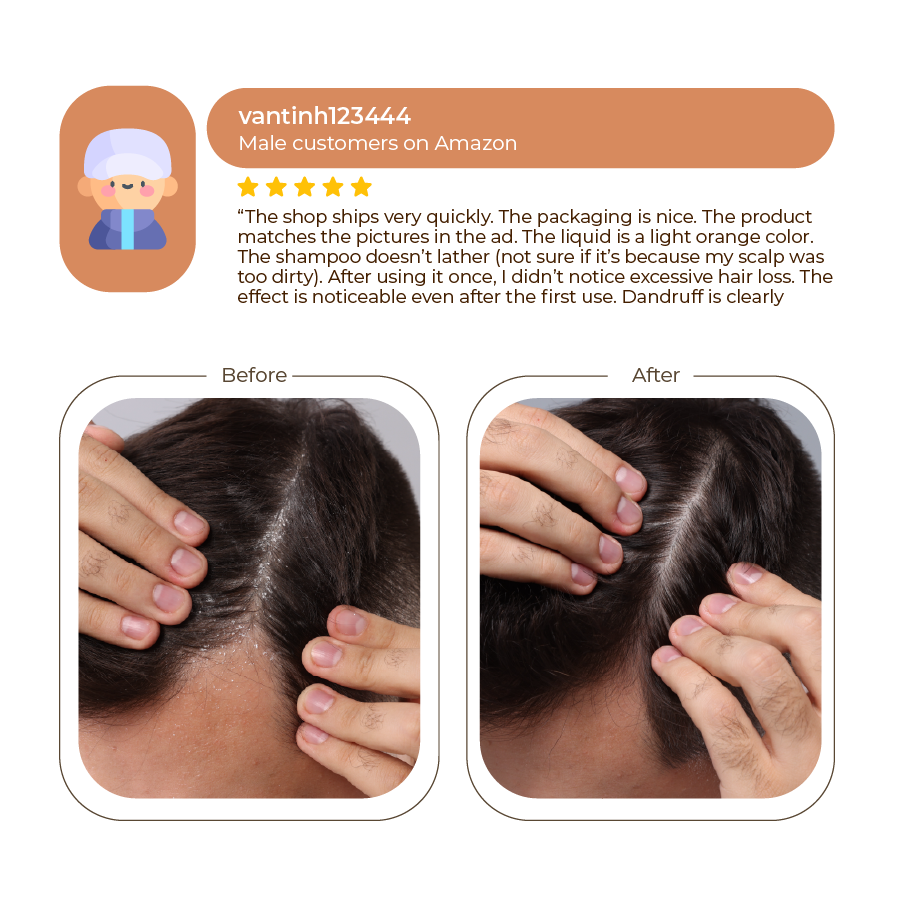 Abera Men Anti-Dandruff Shampoo 200ml