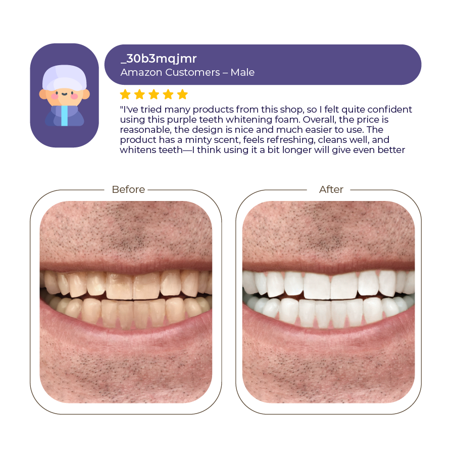 Abera Men Teeth Whitening Foam