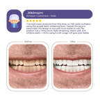 Abera Men Teeth Whitening Foam