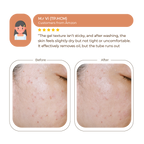 Abera Turmeric Face Wash Gel 100ml