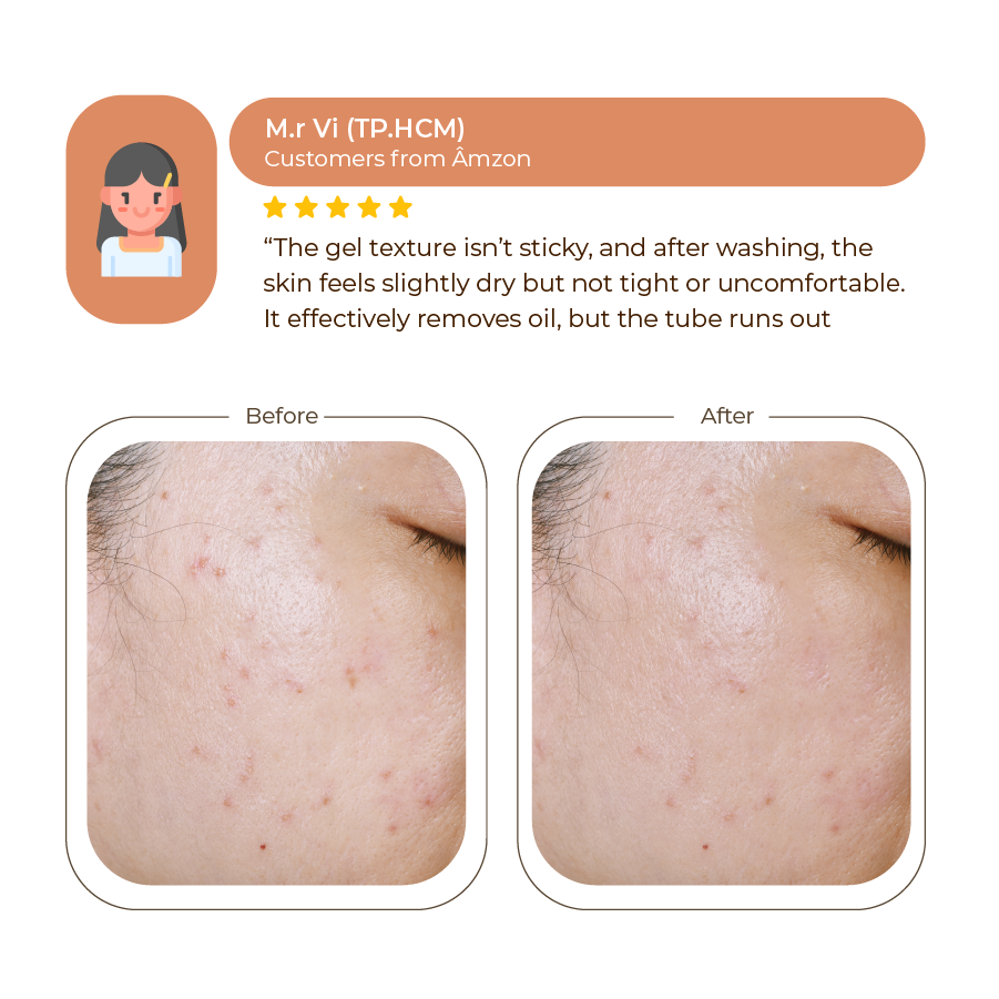 Abera Turmeric Face Wash Gel 100ml