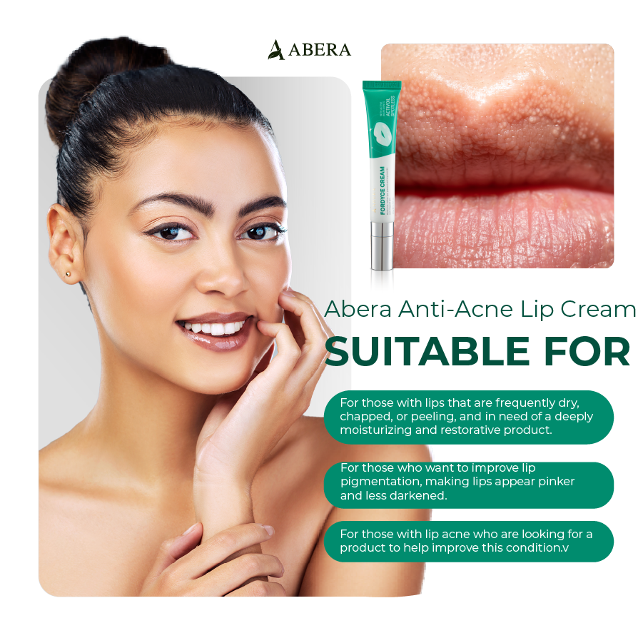 Abera Fordyce Lip Acne Cream 20ml | Gentle Care for Fordyce Spots & Lip Bumps