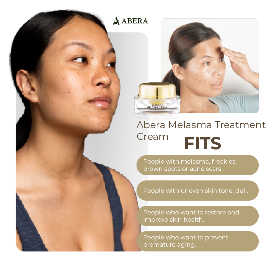 Abera Melasma Treatment Cream 30ml