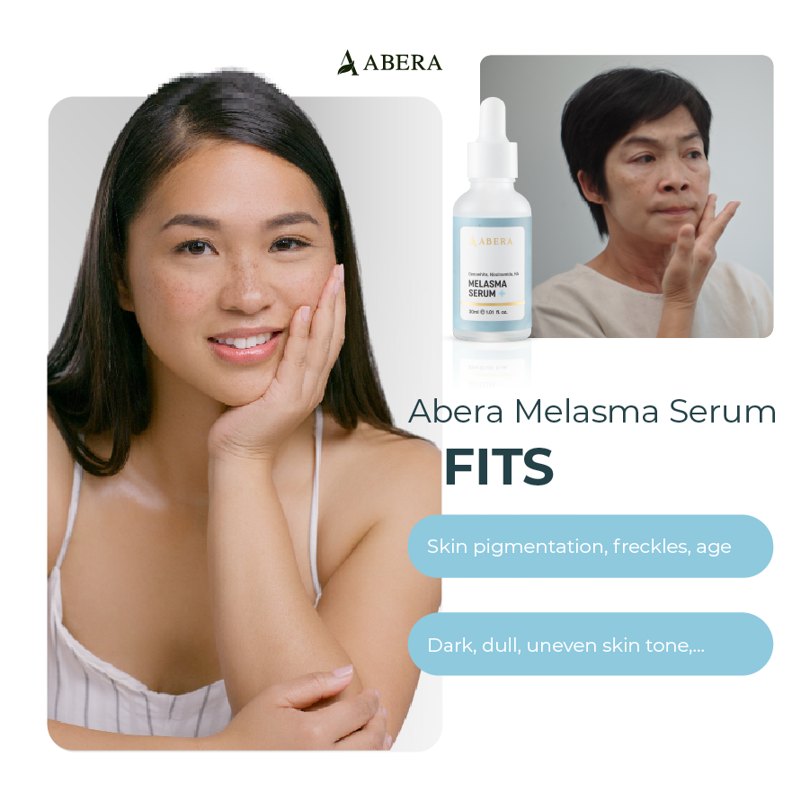 Abera Melasma Serum Treatment 30ml