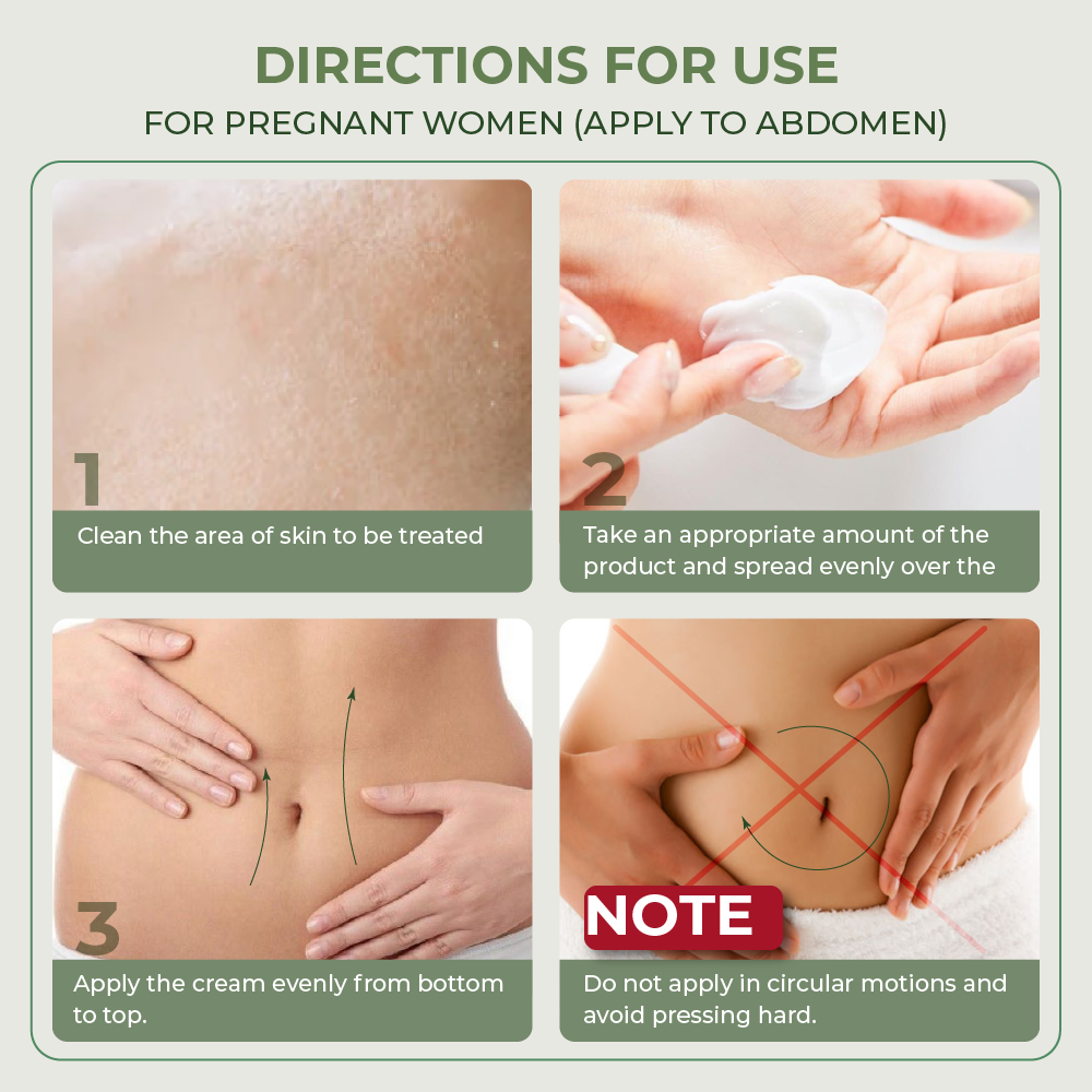 Abera Stretch Mark Cream 50ml