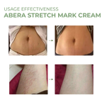 Abera Stretch Mark Cream 50ml
