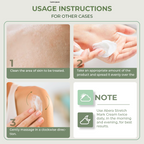 Abera Stretch Mark Cream 50ml